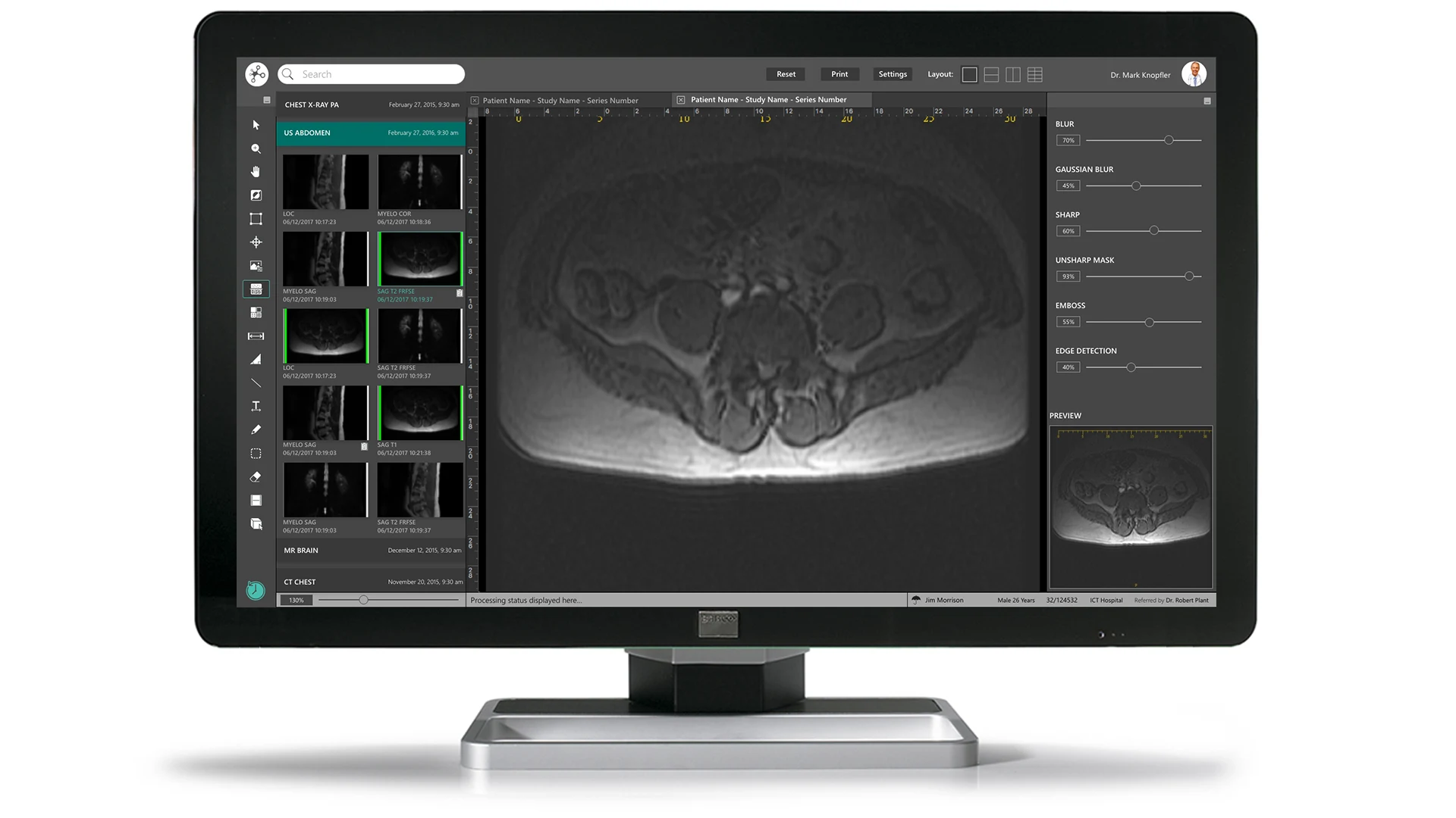 HINAI ImageNet module interface